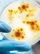 Management of an Emerging Multidrug-Resistant Fungus: Candida auris