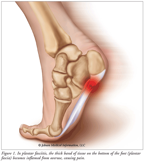 Foot Pain Etiology: An Overview